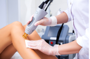 laser hair treatment