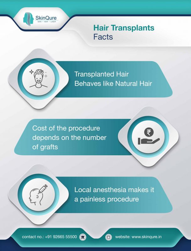 hair transplant facts