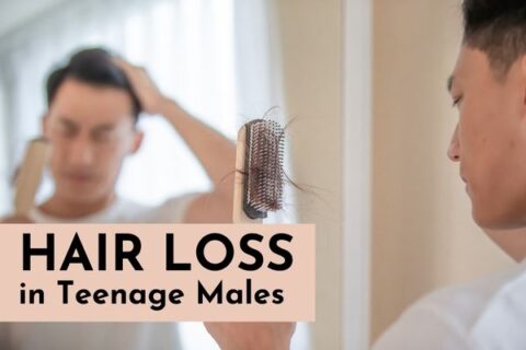 hair loss in teenage males
