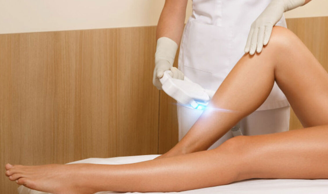 Reasons-Why-Laser Hair Removal Is Gaining Popularity