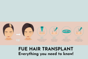 FUE hair transplant