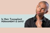 is hair transplant safe and permanent