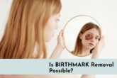 is birthmark removal possible?