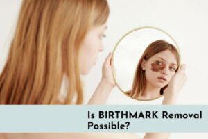 is birthmark removal possible?