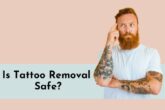 is tattoo removal safe?
