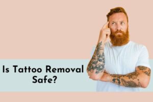 is tattoo removal safe?