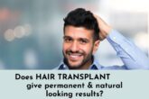 doea hair transplant give permanent and natural looking hair?