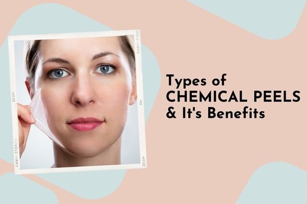 Types of chemical peels and its benefits
