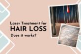 Laser treatment for hair loss