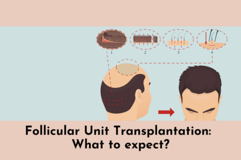 Follicular Unit Transplantation