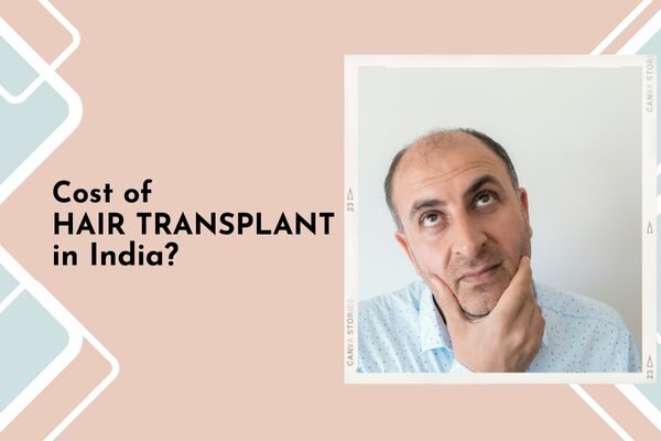 What Is The Hair Transplant Cost In India? - SkinQure