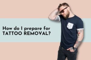 How do I prepare for tattoo removal