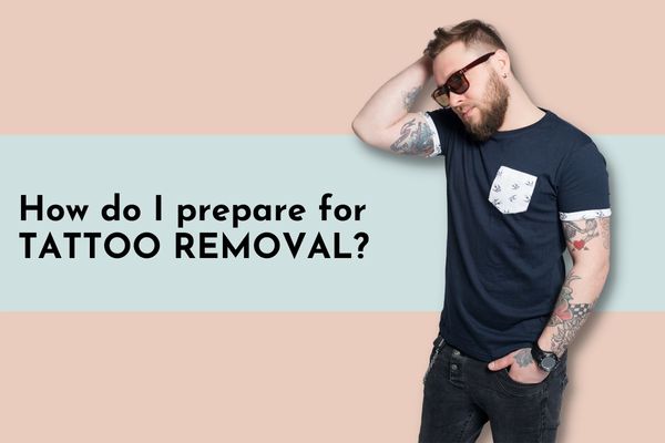 How do I prepare for tattoo removal