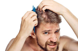 Ways-to-Remove-Scabs-After-Hair-Transplant