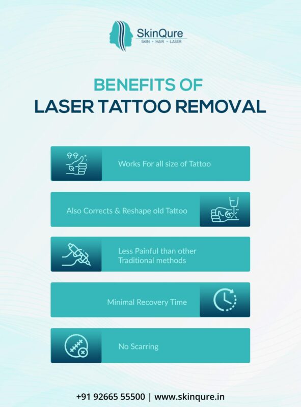 Benefits of Laser Tattoo Removal