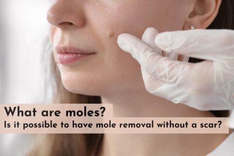 mole removal without scars
