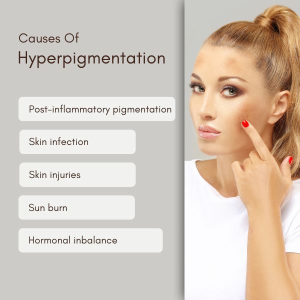 common causes of hyperpigmentation