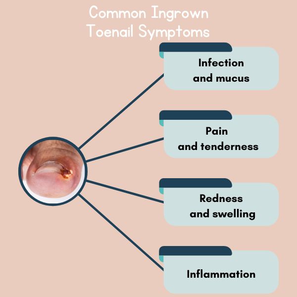 common symtoms of ingrown toenail