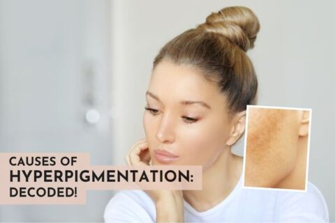 Causes of hyperpigmentation