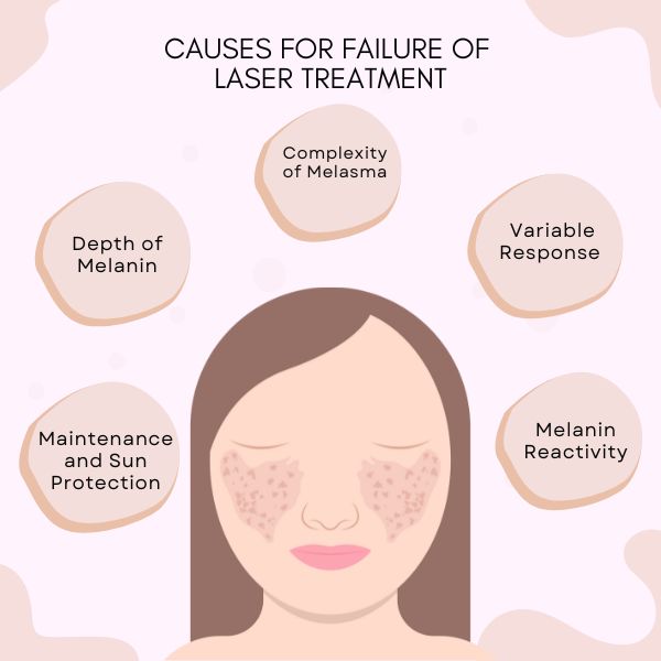 Causes of laser treatment falures in Melasma