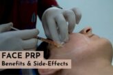 face prp in delhi