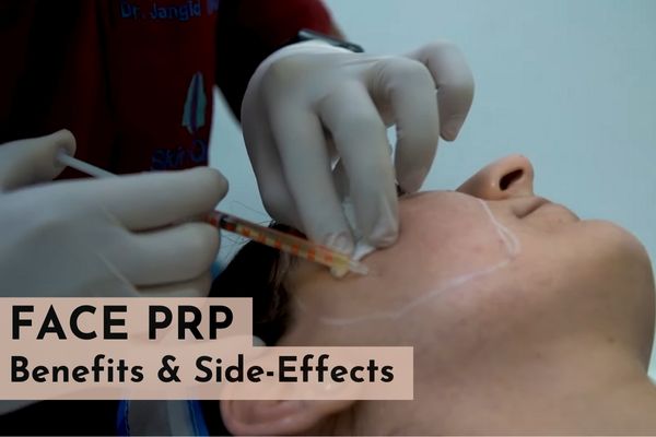 face prp in delhi