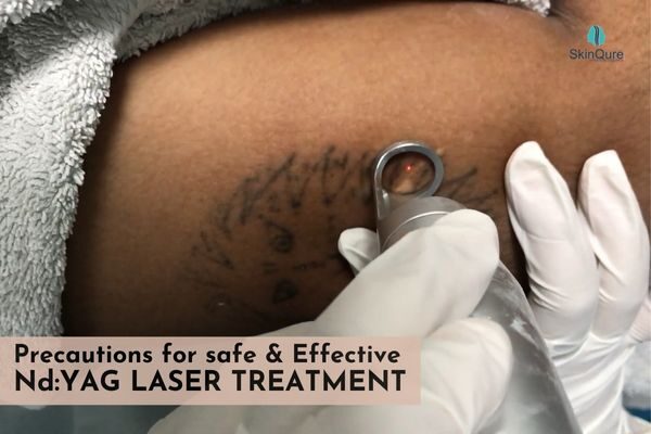 Laser tattoo/permanent makeup removal | Cosmetic dermatology Elm Clinic