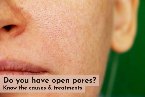 Open Pores