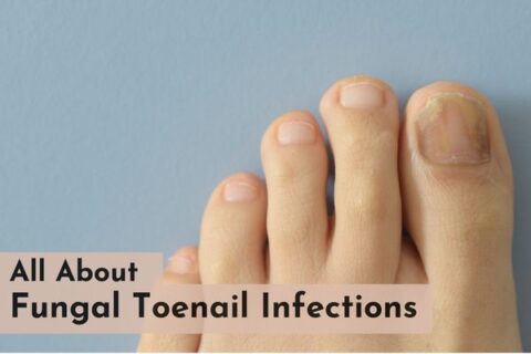 Learn about fungal toenail infections