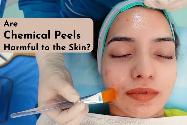 are chemical peels harmful to the skin?