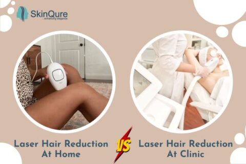 laser hair reduction at home vs clinic