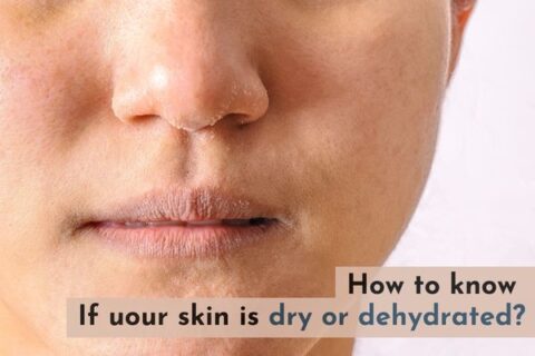 dry skin