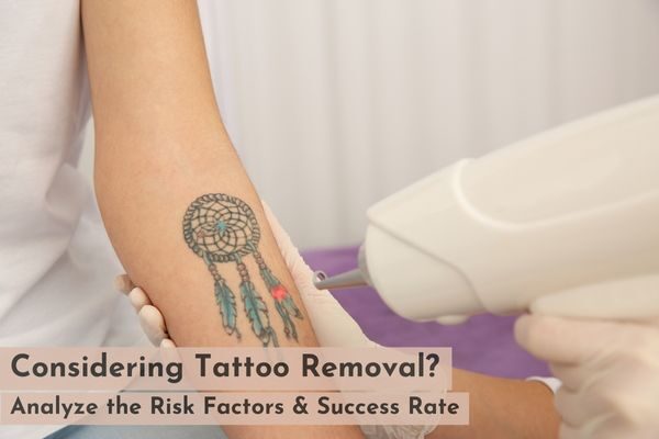 The Latest Technology in Tattoo Removal at PDG - Peraza Dermatology Group