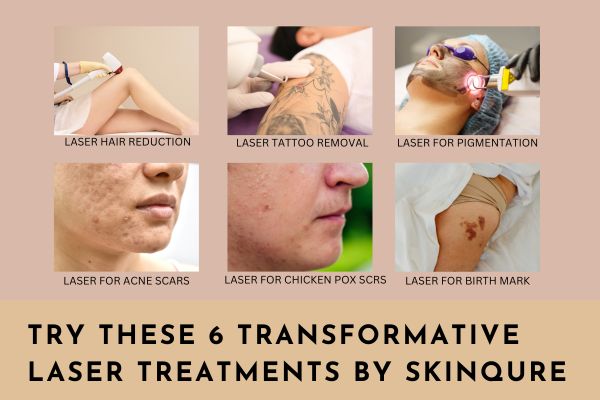 6 Success Factors of Tattoo Removal | Kitagawa Dermatology