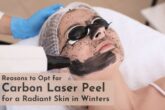 carbon laser peel