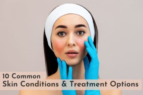 common skin conditions and their treatment