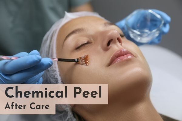 chemical peel aftercare