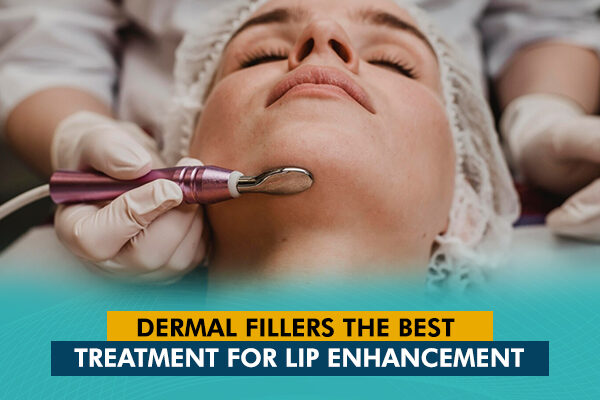 Dermal Fillers