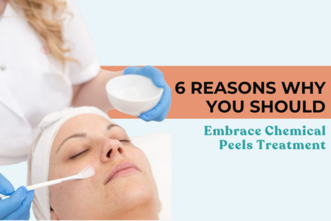 Chemical Peels Treatment