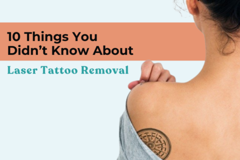 Laser Tattoo Removal