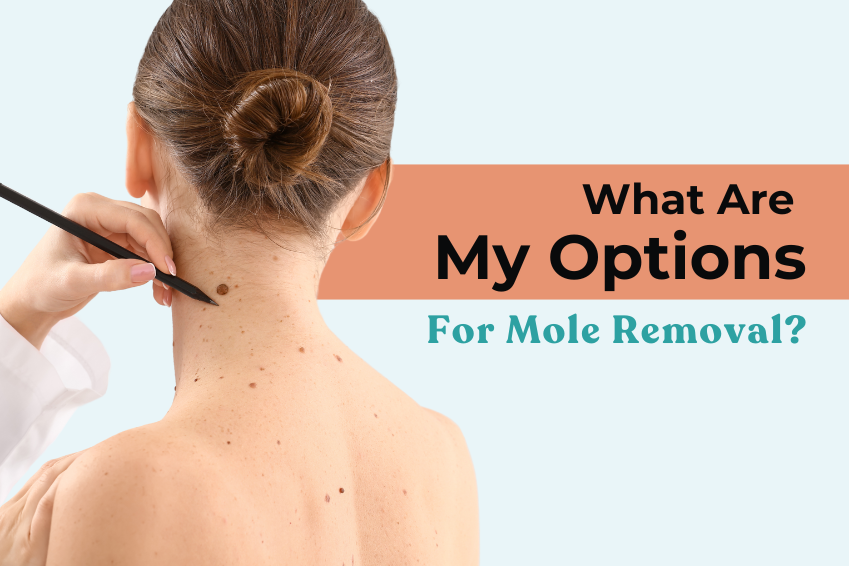 Mole Removal