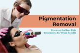 pigmentation removal