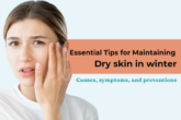 Dry skin in winter