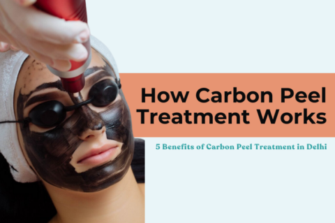 Carbon Peel Treatment in Delhi