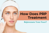 PRP treatment in Delhi