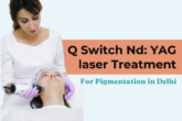 Nd YAG laser Treatment