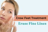 Crow Feet Treatment