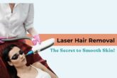 Laser Hair Removal