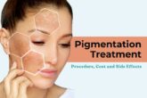 Pigmentation Treatment