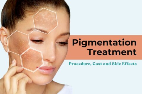 Pigmentation Treatment